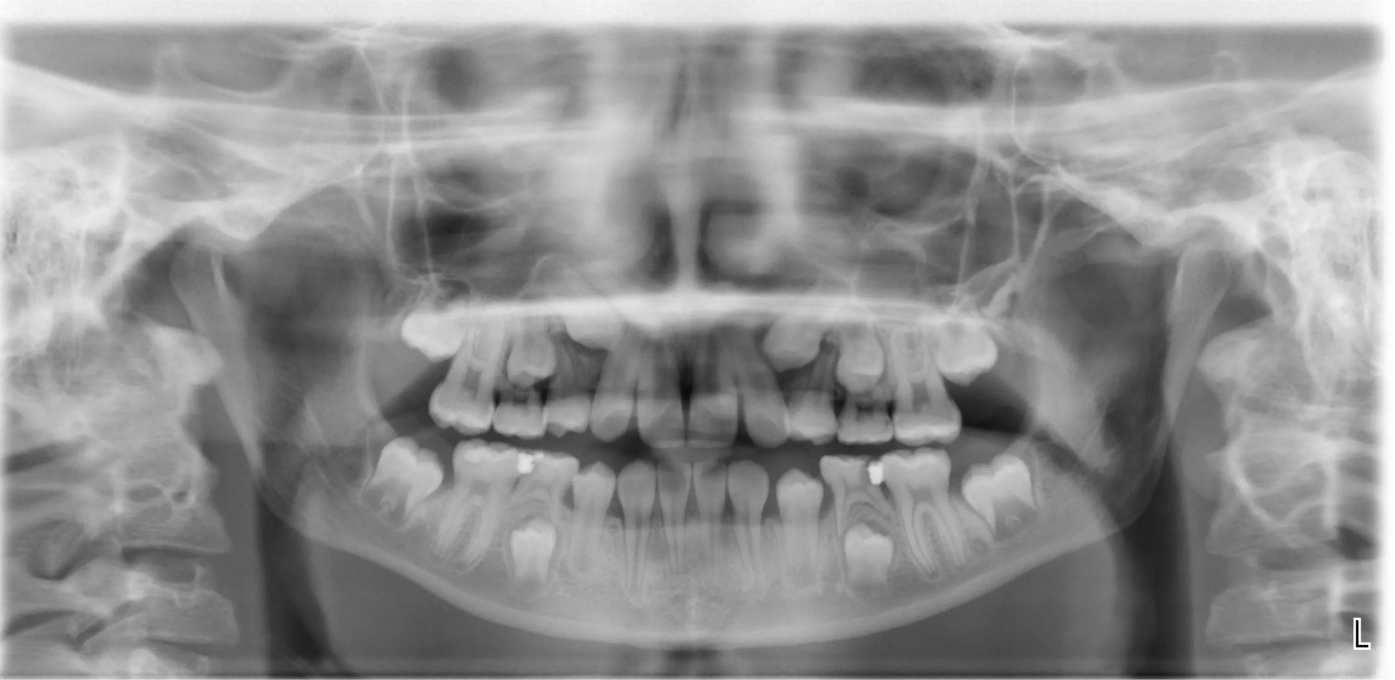 RADIOGRAFIA PANORAMICA - Dettaglio