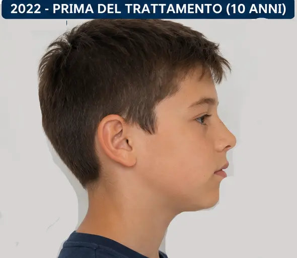Il sorriso a 12 anni - Foto 2