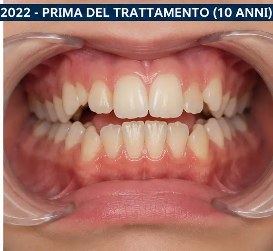 Il sorriso a 12 anni - Foto 3