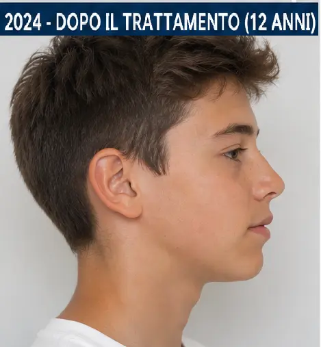 Il sorriso a 12 anni - Foto 5